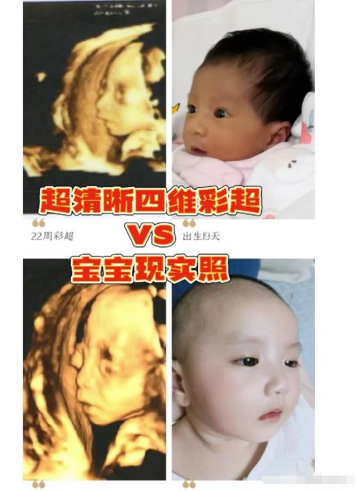 AI预测宝宝长相项目拆解思路，你get到了吗？-第2张图片-好推首码网